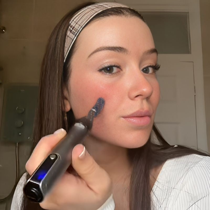 NovaDerm M8S At-Home Microneedling Pen For Skin Renewal