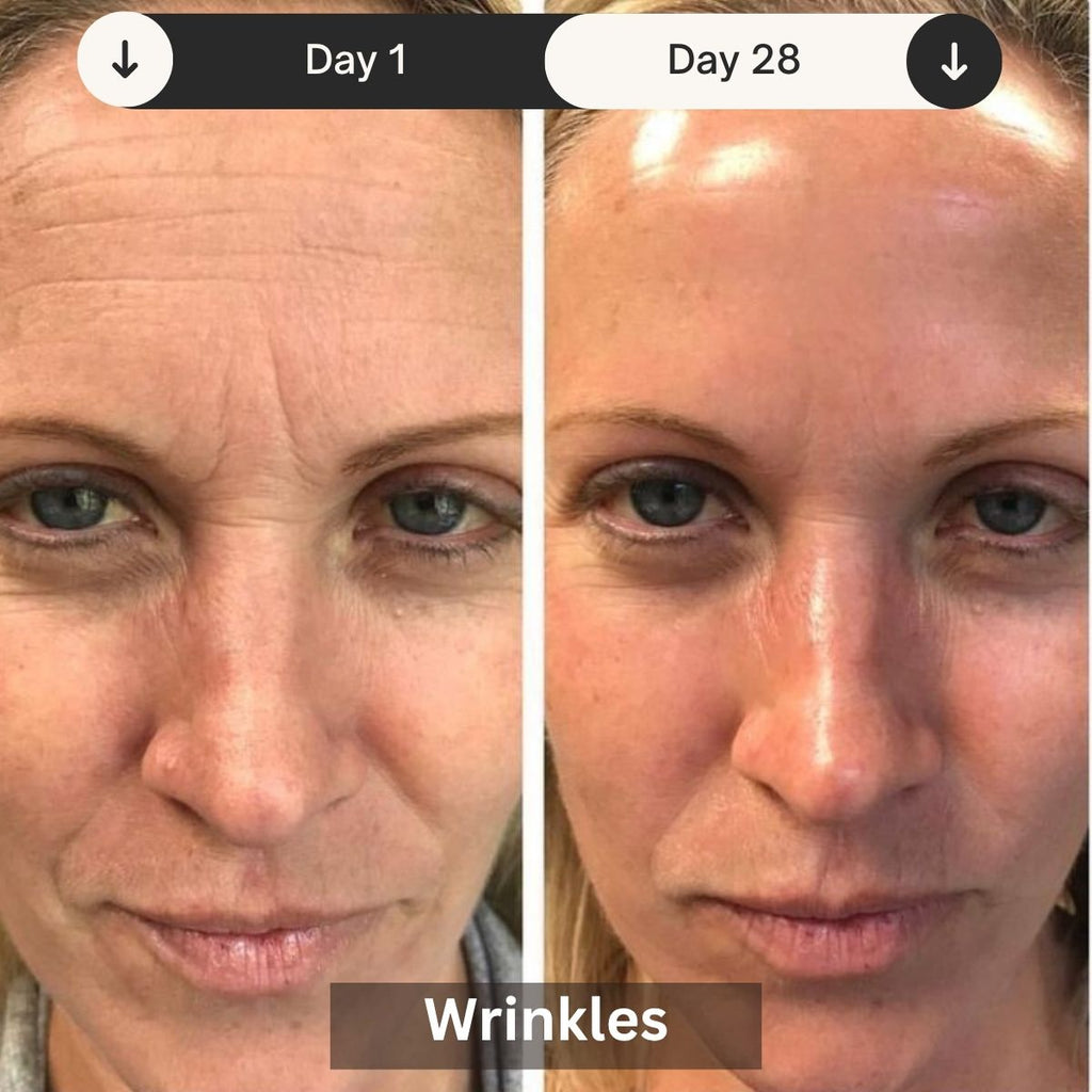 LED Skin Rejuvenation Device For Clinic And Home Use