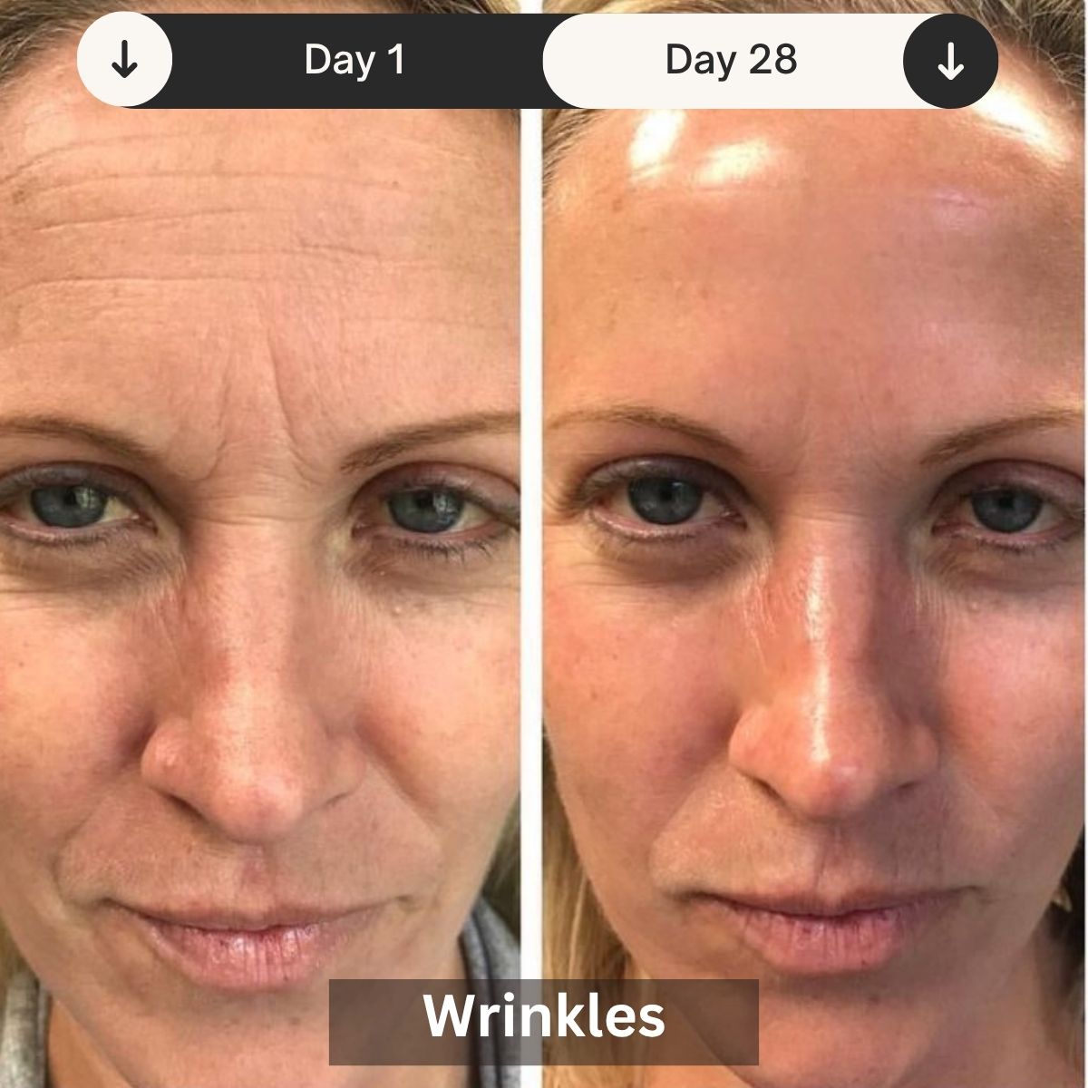 LED Skin Rejuvenation Device For Clinic And Home Use