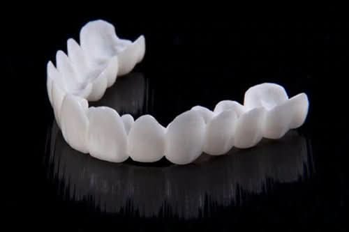 SmileFlex bílé fazety zubní protézy pro jemný a přirozený úsměv
