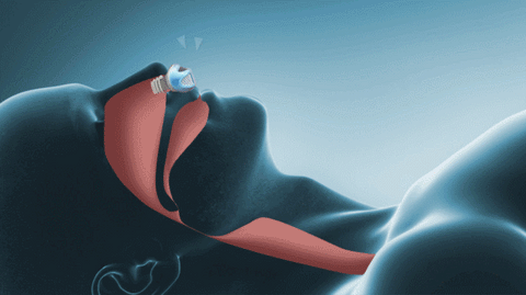 Unité de thérapie du sommeil compacte à usage domestique QuietBreath | Atiets