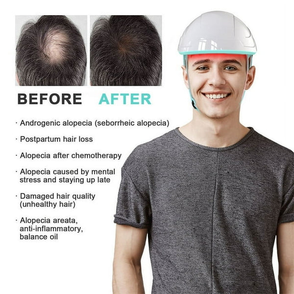 Device For Scalp Care Using A Laser Cap To Help Follicles