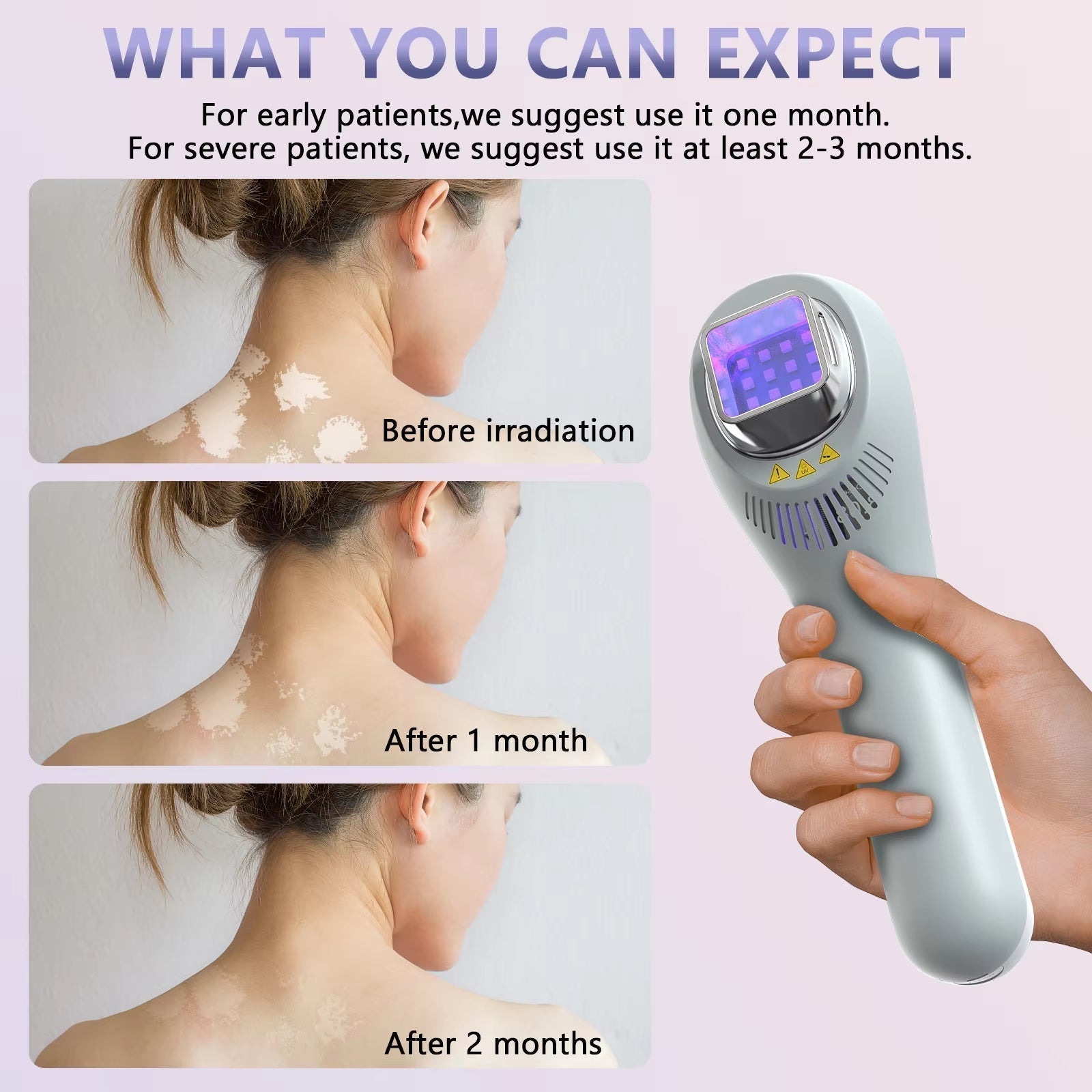 308 Nm Skin Care Light With Three-Head System For Face, Neck And Limbs