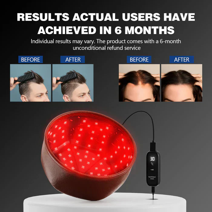 AstraGrowth 1.0 Pro Edition Scalp Growth Cap For Daily Use
