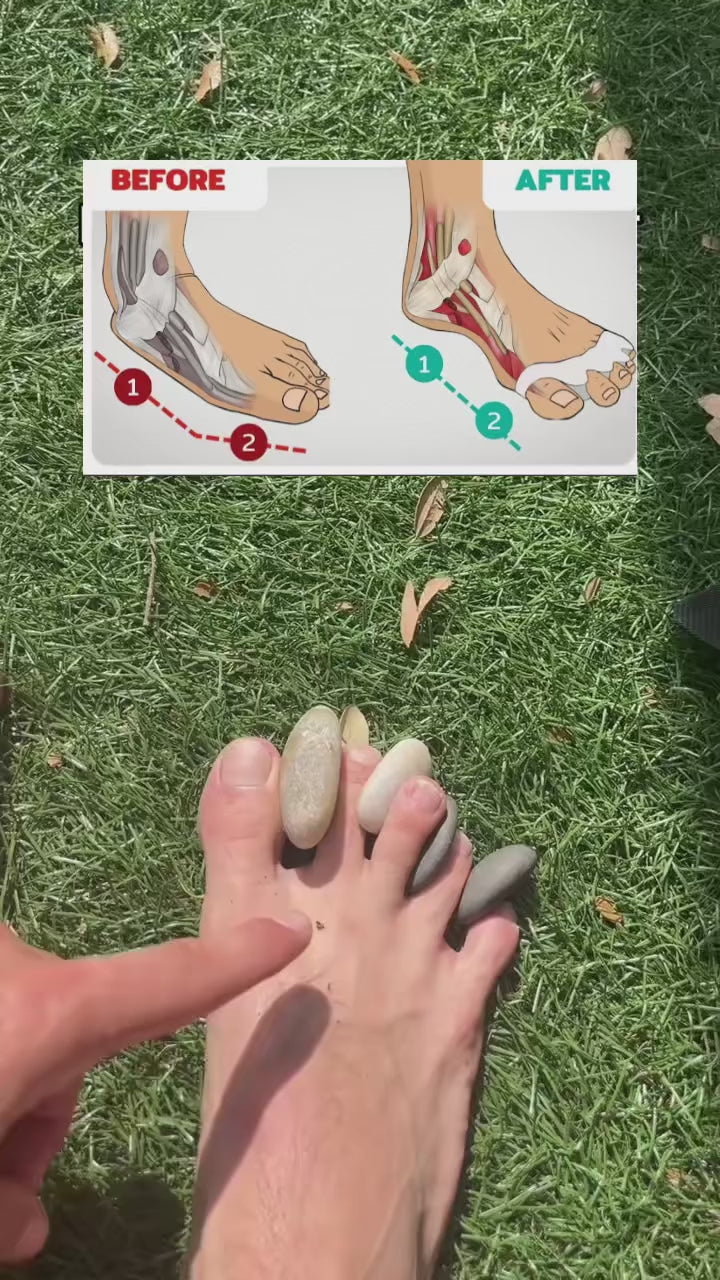 NovaStride Align Silicone Toe Spacers For Healthy Foot Alignment