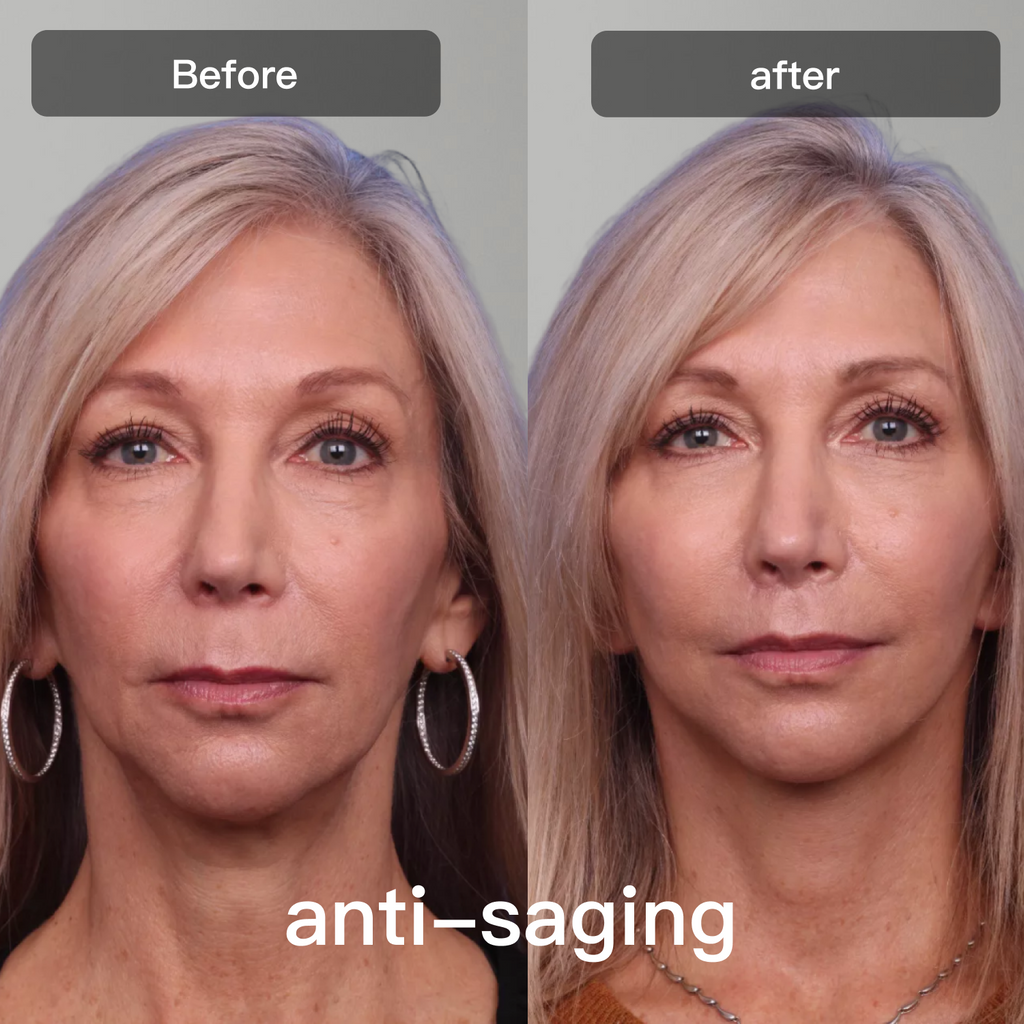 Face And Body Skin Care With Multicolor LED Light For Smoothing And Texture