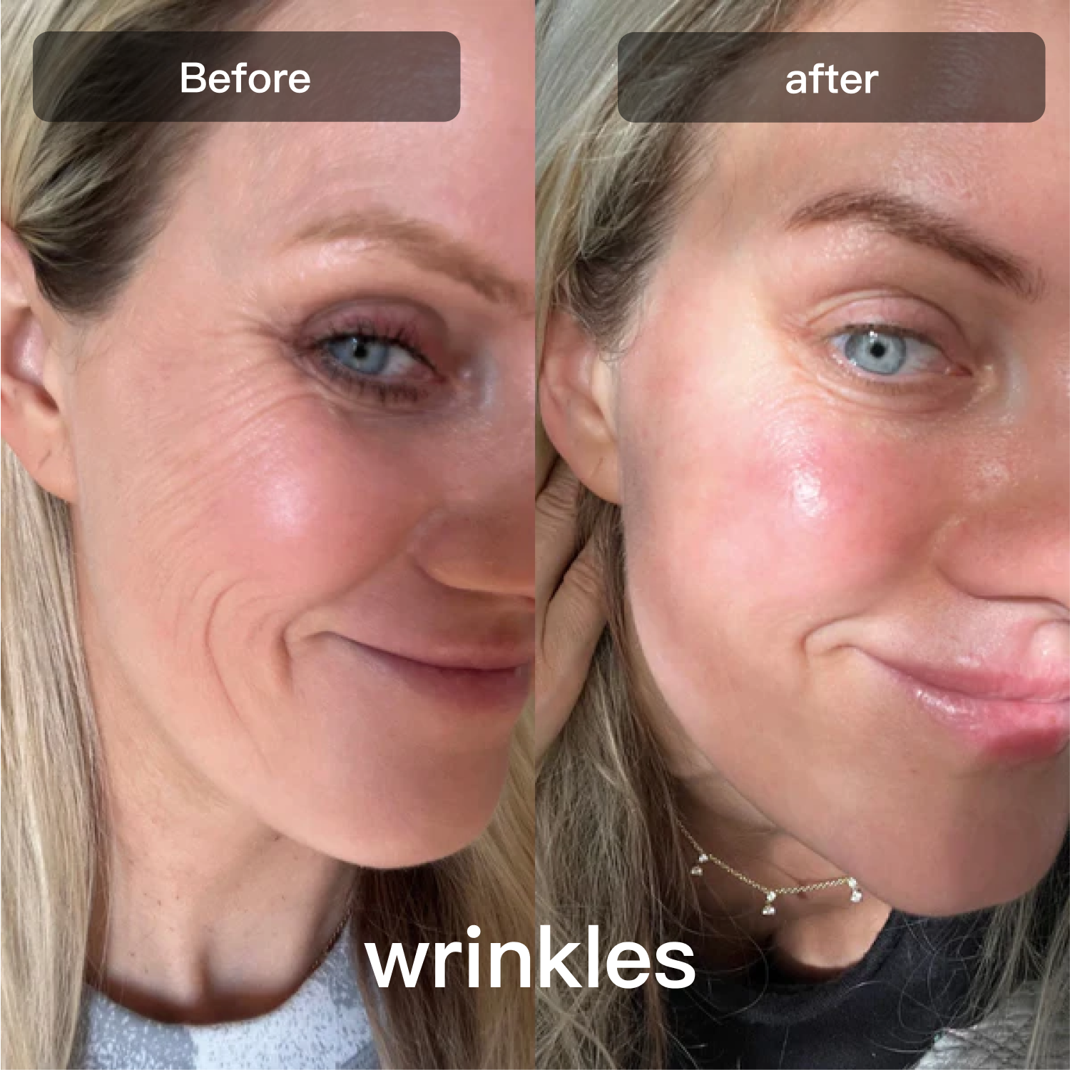 Face And Body Skin Care With Multicolor LED Light For Smoothing And Texture
