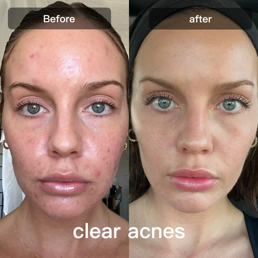 Face And Body Skin Care With Multicolor LED Light For Smoothing And Texture